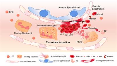 Review: The Emerging Role of Neutrophil Extracellular Traps in Sepsis and Sepsis-Associated Thrombosis
